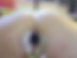 Speculum Anal