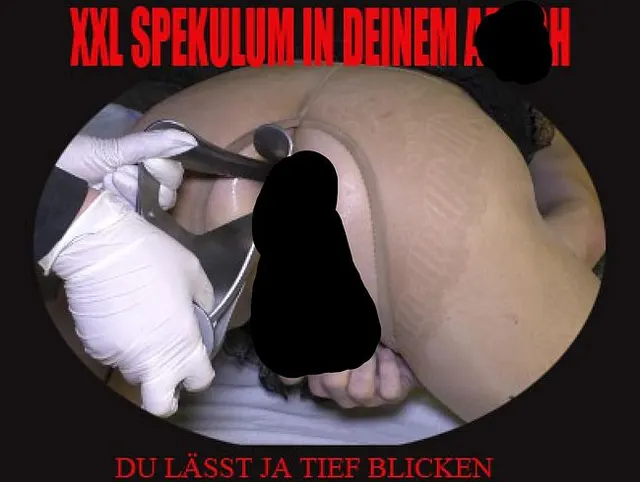 XXL SPEKULUM IN DER ARSCHFOTZE