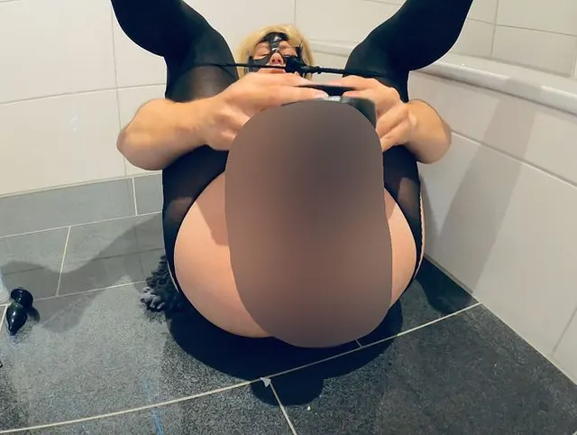 Analfotze gedehnt