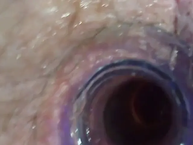 Der kleine Test mit dem Anal Tunnel