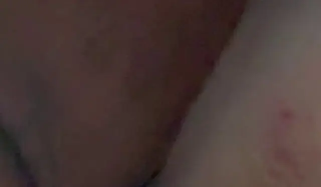 Bissle Anal ?